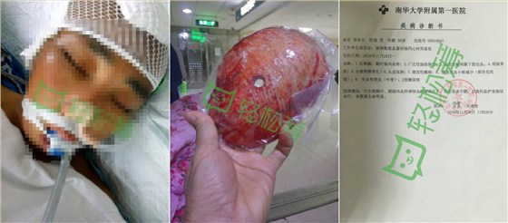 一方有難，八方支援！數(shù)碼彩公司為車(chē)禍經(jīng)銷(xiāo)商募捐獻(xiàn)愛(ài)心